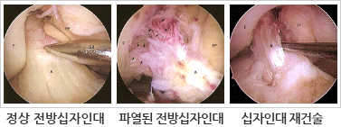 보존적방법