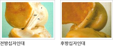 재건술