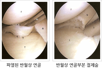 치료
