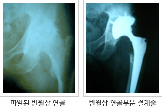 정의